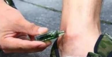 被蚊子咬后，怎样止痒快速有效？