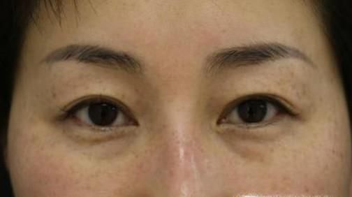 小春沙棘油的功效与作用