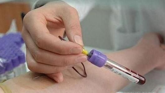 夏季女性嗜睡易疲劳怎么办？