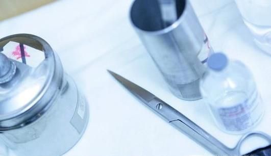 如何正确处理手上的倒刺？倒刺发炎了怎么办？