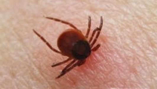 夏季如何预防病毒性出血热？