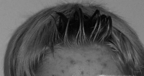 牙膏洗脸有什么好处？