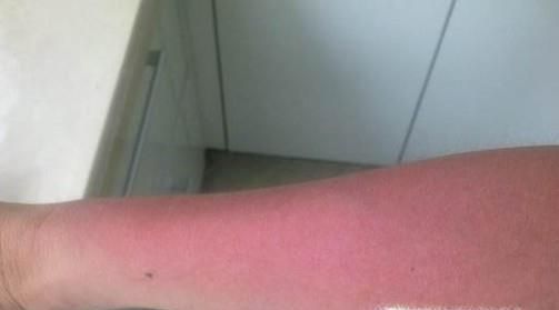 牙膏洗脸有什么好处？