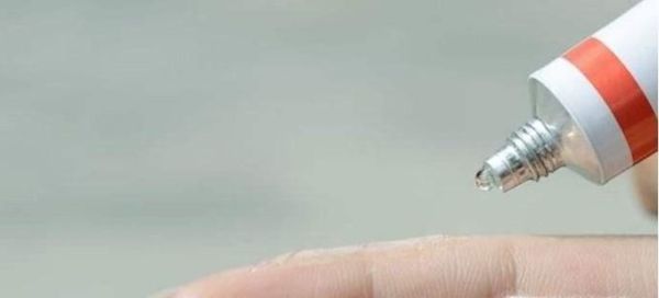 手上的湿疹的治疗方法