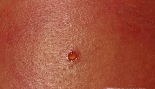 红糖有哪些意想不到的好处？