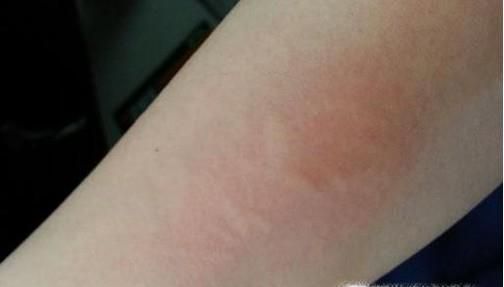 空腹吃螃蟹会怎么样？哪些人群不适合吃螃蟹？