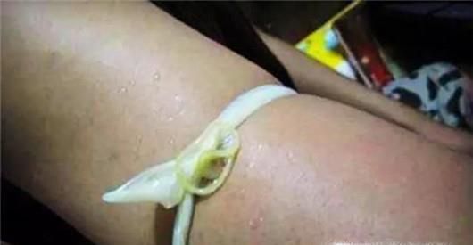 夏季如何防止被蛇咬？被蛇咬伤后如何紧急处理？