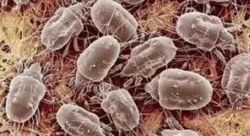 如何杀死房间里的螨虫