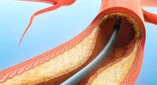 白酒泡大蒜的功效