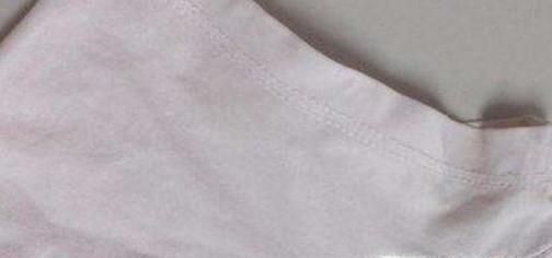 衣服腋下发黄怎么办