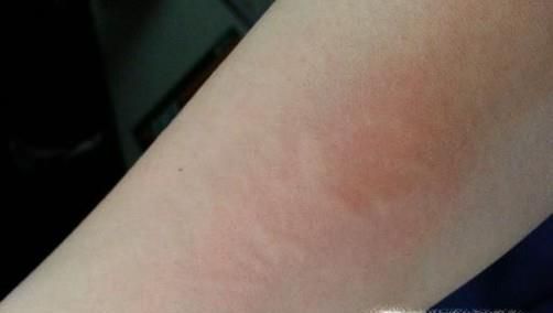 什么人容易得癌症