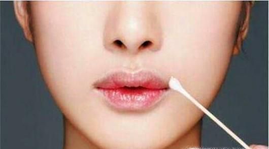 立秋后经常烂嘴角怎么办?该如何预防烂嘴角?