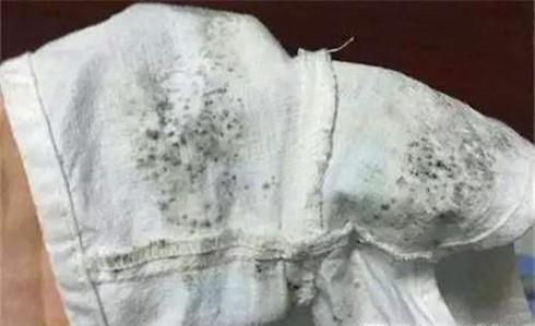 衣服发霉了怎么洗掉