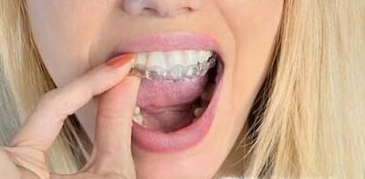 带牙套的好处和坏处有哪些