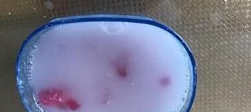 夏季被蚊子叮咬怎么办？处理蚊子叮咬伤口小窍门