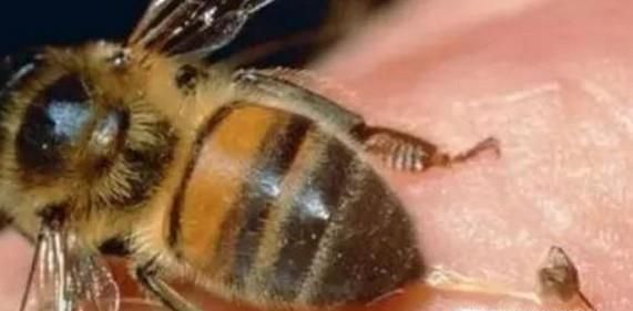 被蜜蜂蛰了的快速处理方式