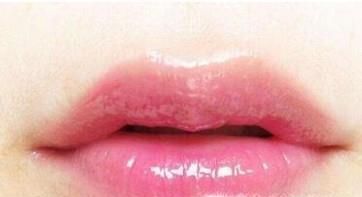 怎样通过嘴唇的颜色看健康