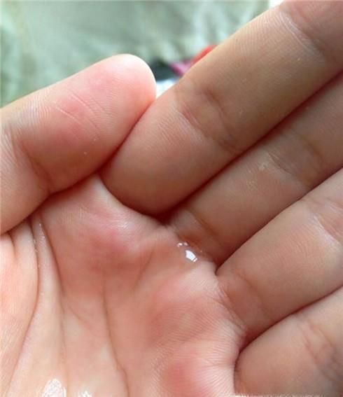 切菜时辣椒辣手怎么处理