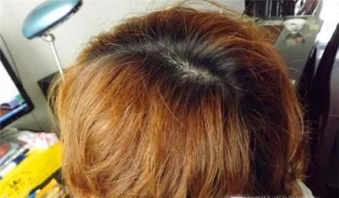 洗完头头发蓬松怎么办