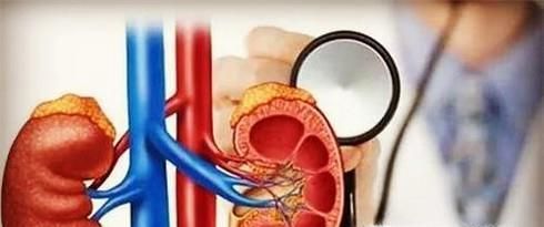 如何利用运动来护肾、养肾