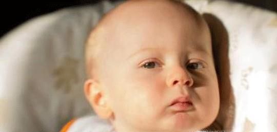 脖子上长湿疹的怎么办