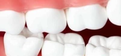 四个让黄牙变白牙的小妙招