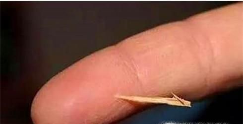 手上扎上小刺的无痛清除法