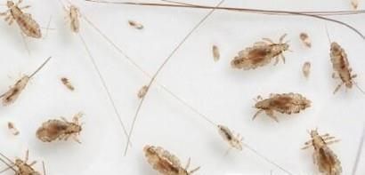 头虱子怎么彻底去除