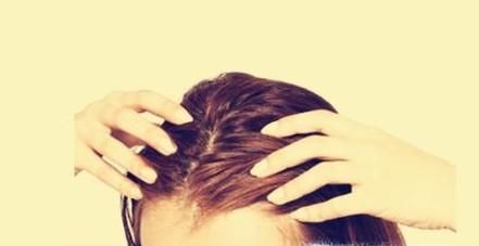 头皮屑多该怎样缓解？