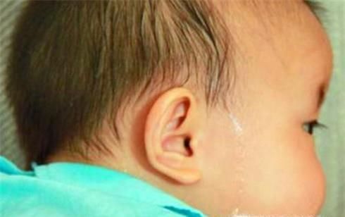 小孩头上爱出汗是怎么回事