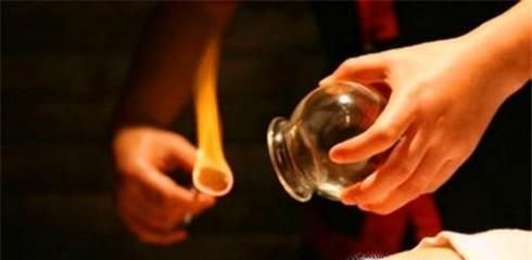 如何进行拔罐才正确?
