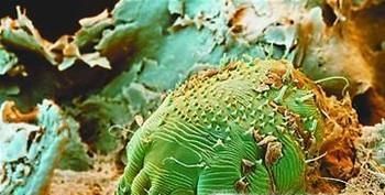 怎样去除衣物上和身上的螨虫