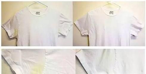 白衣服放久了发黄怎么办