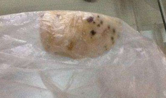 馒头发霉了去掉皮还能吃吗