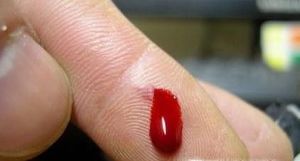 刀割到手怎样处理