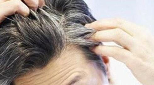 长期湿发入睡的危害有哪些