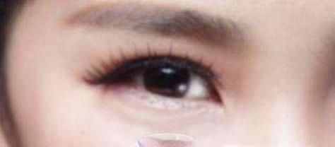 如何选择正确的隐形眼镜，度数，类型，保护眼睛