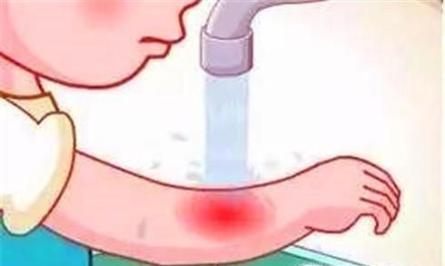 如何预防伤口感染发炎？