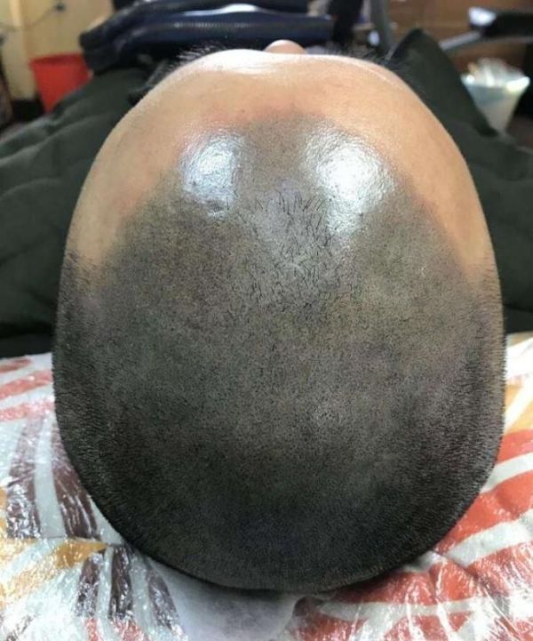 “纹发”什么是纹发