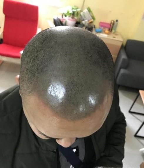 “纹发”什么是纹发