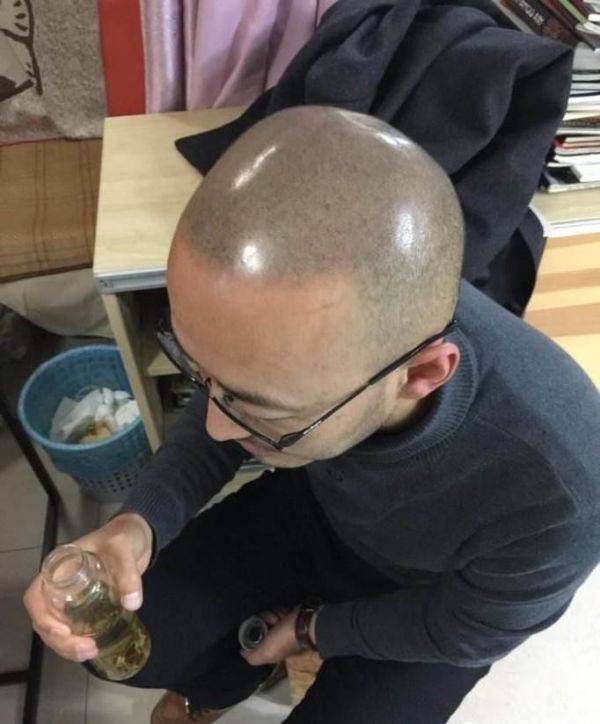 “纹发”什么是纹发