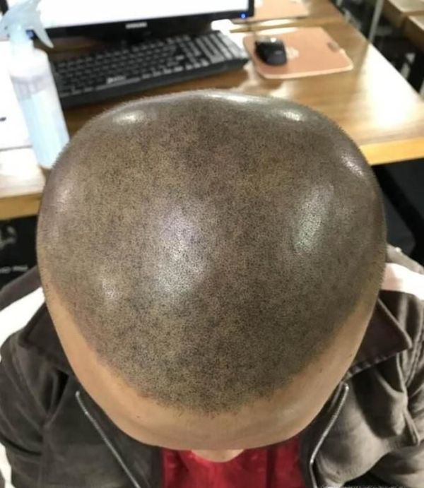 “纹发”什么是纹发