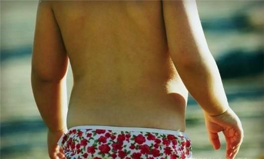 如何防止宝宝感染阴虱病？记住八点远离阴虱病！