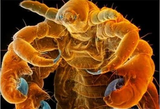 如何防止宝宝感染阴虱病？记住八点远离阴虱病！