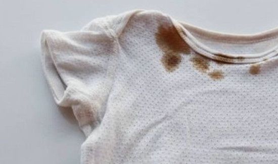 衣服有精油印怎么洗掉