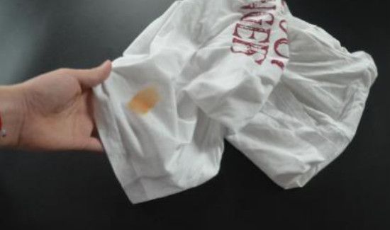 衣服有精油印怎么洗掉