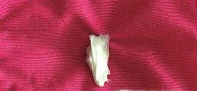 口香糖粘在衣服上了怎么去掉衣服上的益达木糖醇