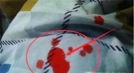 床单刚染上血怎么快速洗掉（不用洗衣粉）