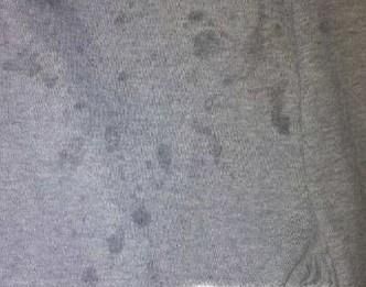 裤子在吃饭时候弄上油怎么办