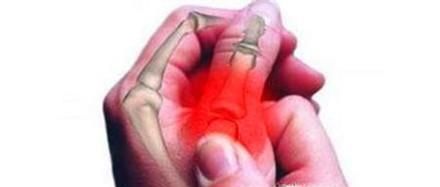 手机病症状有哪些？如何判断自己是否得手机病？